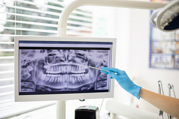 Detección de afecciones dentales a través de IA y rayos X propuesta por investigadora de UNIB